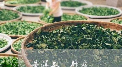 普洱茶 肝癌/2023042831738